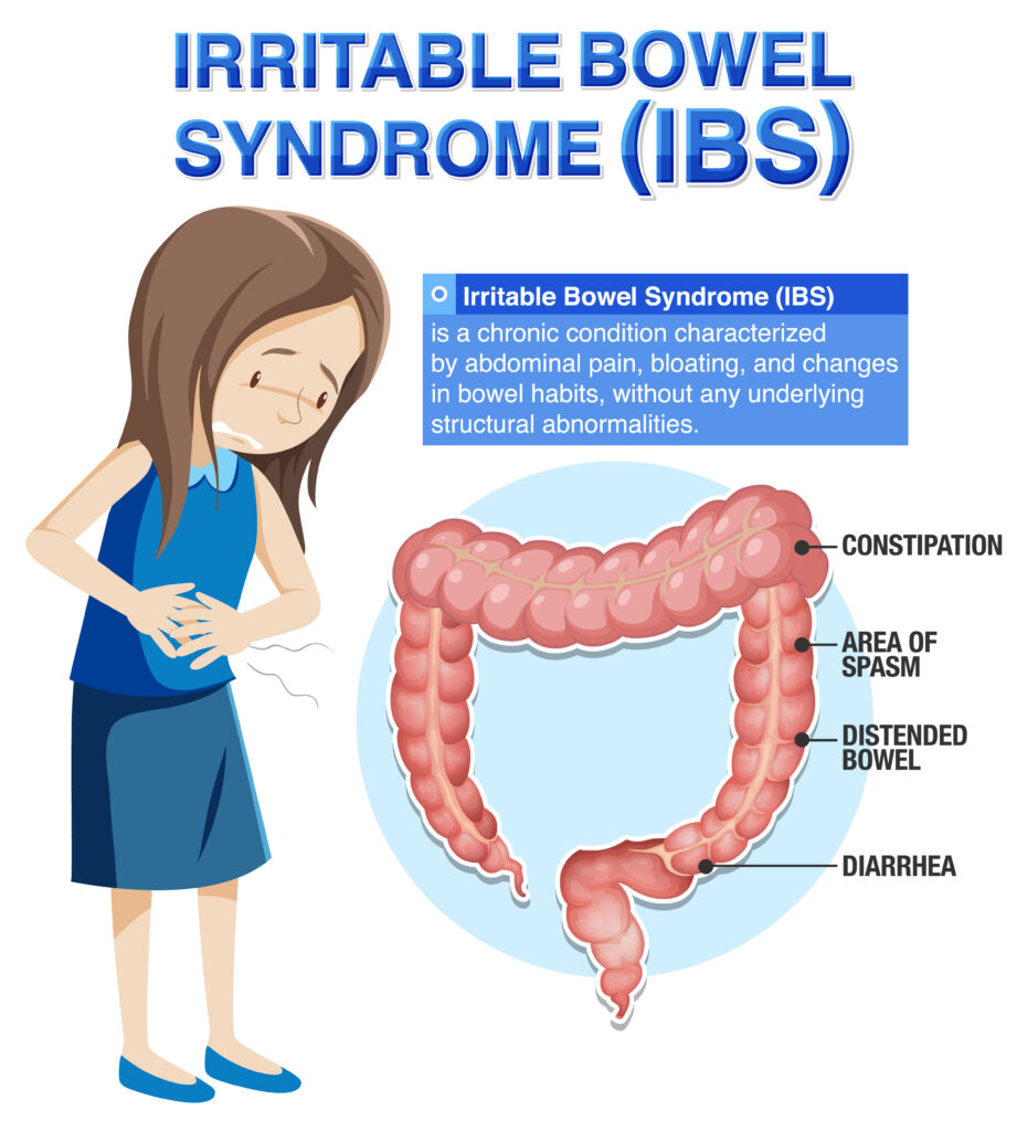 Best IBS Treatment in Ahmedabad